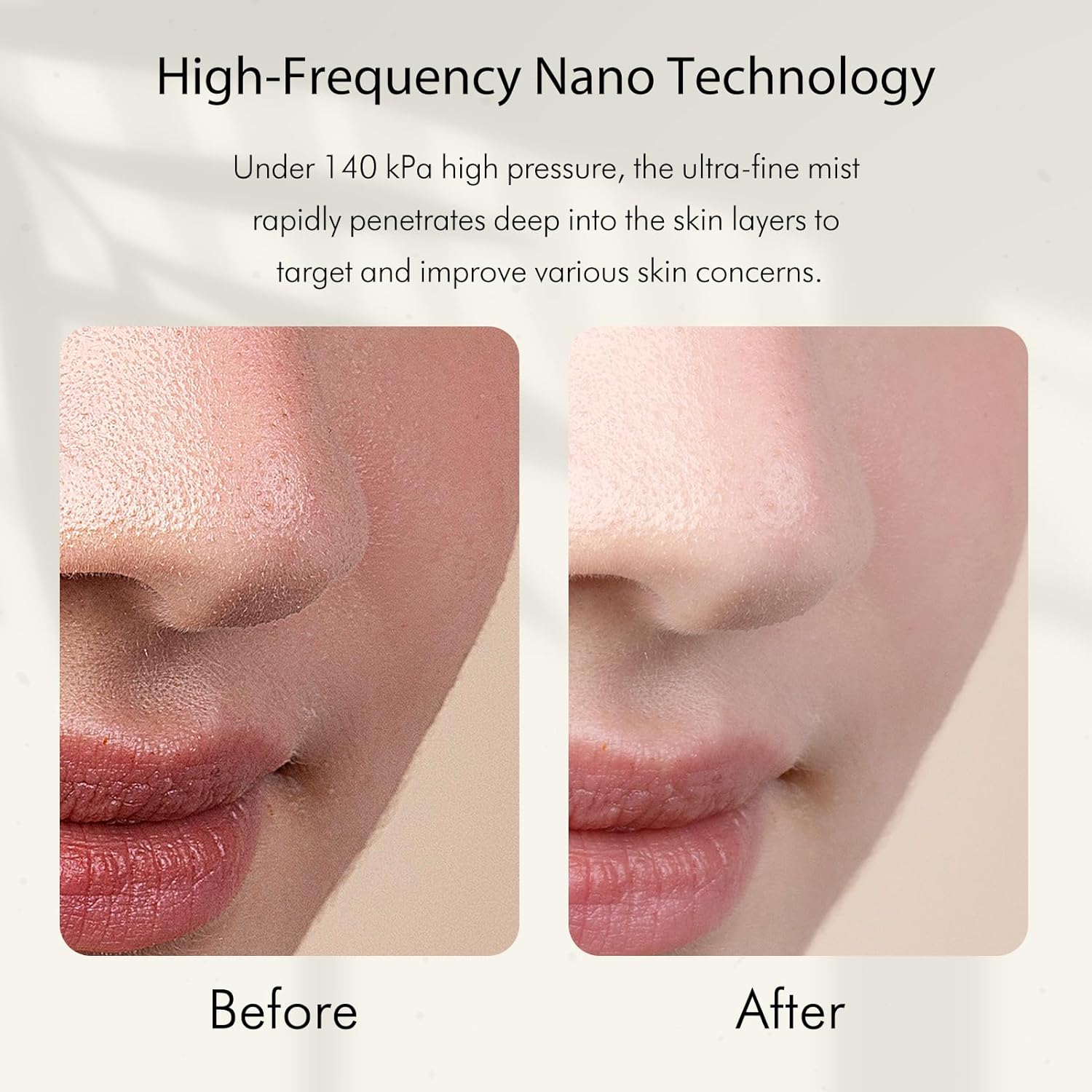 Nano-Ionischer Kaltnebel-Gesic – Face Steamer Bewertung und Preis